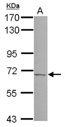 PSR antibody