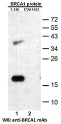 BRCA1 (1-120)