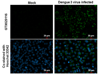Dengue virus Envelope protein 