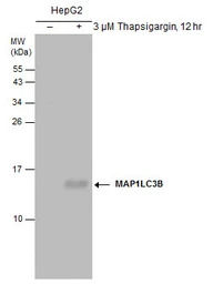 LC3B antibody [GT3612]