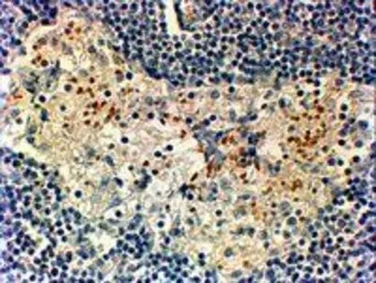 FOXC2 antibody, C-term