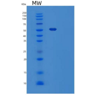 小鼠玻连蛋白/ VTN重组蛋白His tag