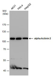 alpha Actinin 2 antibody [GT12