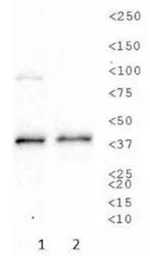 Sodium/Potassium ATPase beta 1
