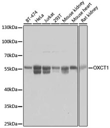 OXCT1 antibody