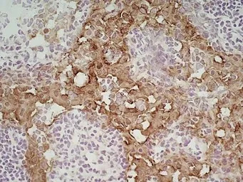 Marco antibody [ED31]