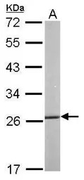 HSP27 antibody