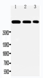 Laminin alpha 2 antibody