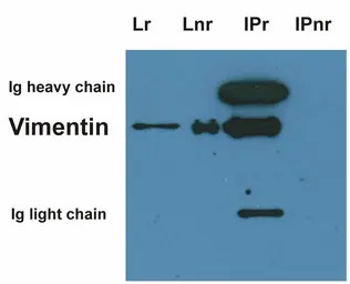 Vimentin antibody [VI-10]