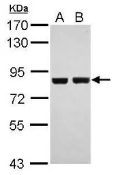 RSK2 antibody