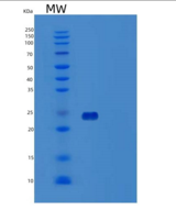 人激活B7-1抗原重组蛋白