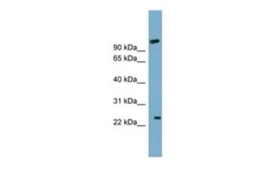 ARL8B antibody, Internal