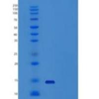 人β2-微球蛋白(b2M)重组蛋白N-6His