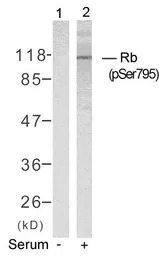 Rb (phospho Ser795) antibody