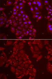 Tripeptidyl peptidase II antib