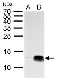 Histone H4K20me3 (trimethyl Ly