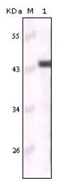Cytokeratin 5 antibody [3E2F1]