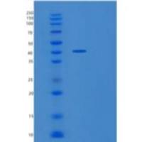 人特雷尔R2/TNFRSF10B/DR5/CD262重组蛋白C-Fc-6His