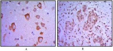 ETS1 antibody [10D2]