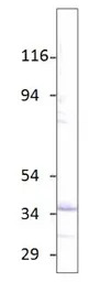 Aquaporin 6 antibody
