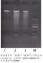 全血DNA小量试剂盒