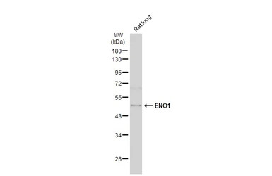 ENO1 antibody [N3C3]