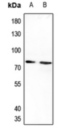 IL20 Receptor alpha antibody