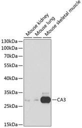 Carbonic Anhydrase III antibod