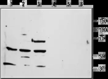 Thrombin Receptor antibody