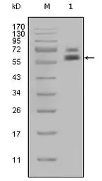 Cytokeratin 5 antibody [1E1]