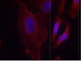 PLCG2 (phospho Tyr753) antibod