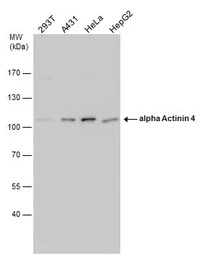 alpha Actinin 4 antibody [N1N2
