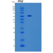 小鼠玻连蛋白/ VTN重组蛋白His tag