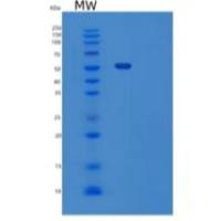 小鼠玻连蛋白/ VTN重组蛋白His tag