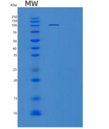 人肝细胞生长因子受体/HGF受体/cMet重组蛋白C-Fc