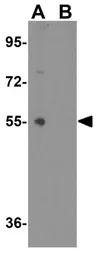 Glycoprotein VI antibody