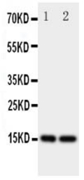 FABP5 antibody