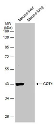 GOT1 antibody [GT638]