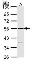 eRF1 antibody