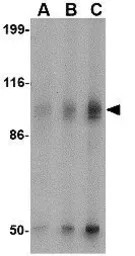 GluR6 antibody