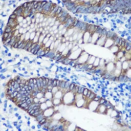 Cytokeratin 8 antibody