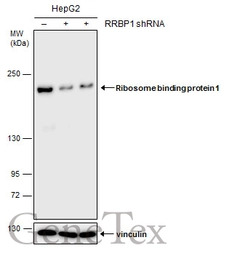 Ribosome binding protein 1 ant