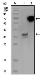 HPS1 antibody [5G12G2]