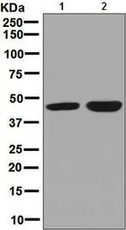 CABP1 antibody [EPR7916]