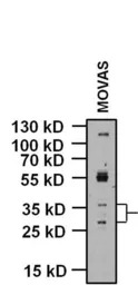KCNMB1 antibody