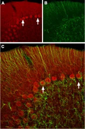 HCN2 antibody