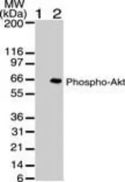 AKT (phospho Ser473) antibody 