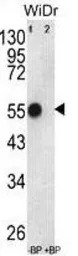 ATP5B antibody, Internal
