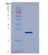 人肿瘤坏死因子α(TNFa)重组蛋白