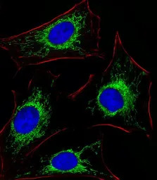 Glutaminase antibody, C-term